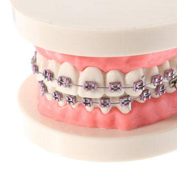 Dental Teeth Malocclusion Orthodontic Model With Full Metal Brackets Hoops Dentist Teaching