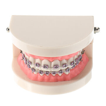 Dental Teeth Malocclusion Orthodontic Model With Full Metal Brackets Hoops Dentist Teaching