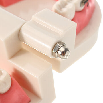 Dental Teeth Malocclusion Orthodontic Model With Full Metal Brackets Hoops Dentist Teaching